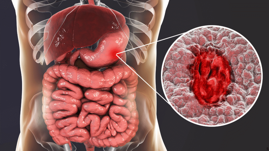 Signs of Unhealthy Gut
